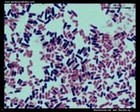 Escherichia coli and Bacillus sp. microscopy
